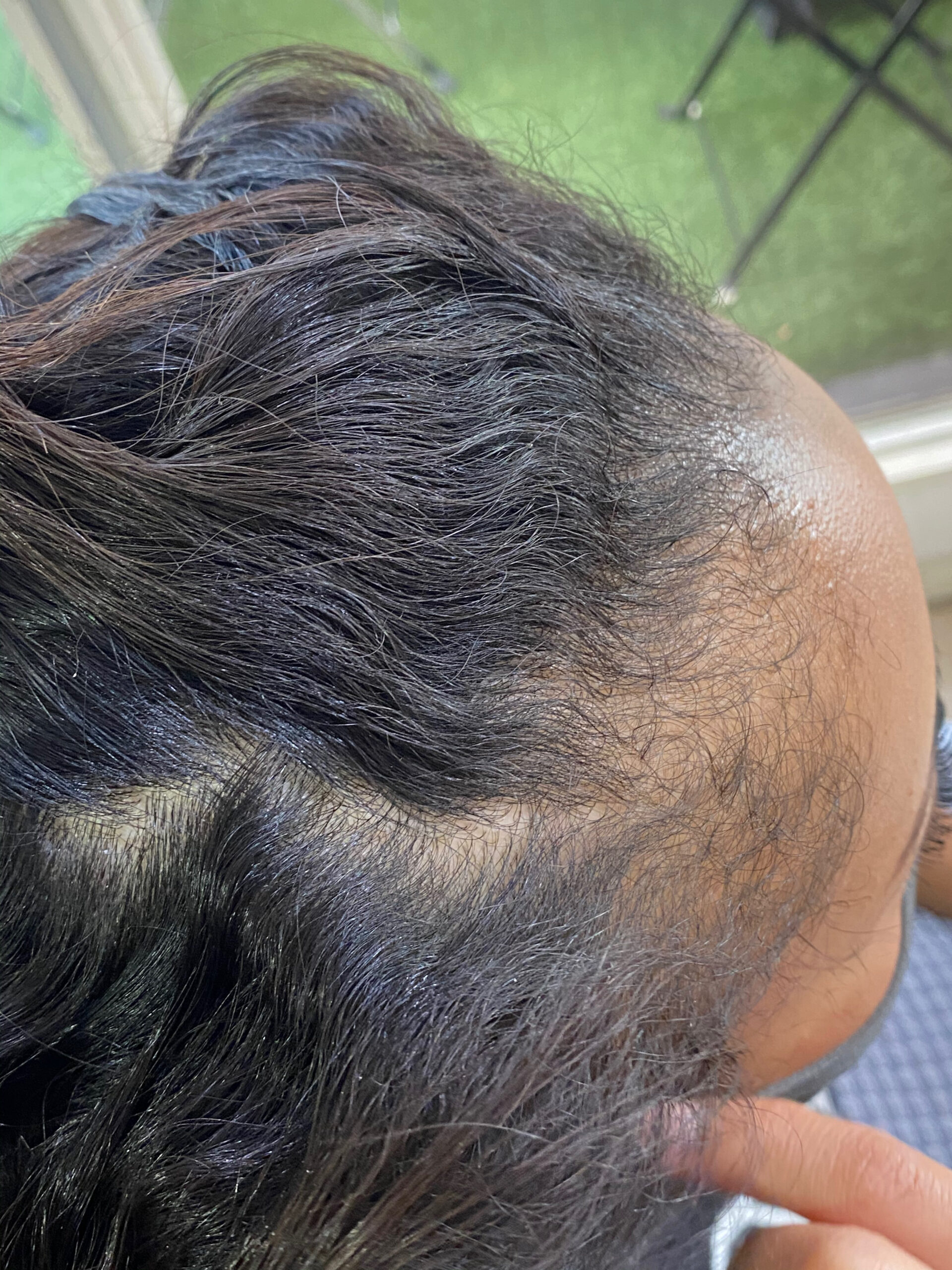 高難易度ジュエリーシステム縮毛矯正【CARELU】で強いくせ毛が気になる方を艶髪ストレートヘア。